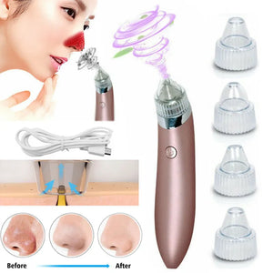 Derma Suction Blackhead Removal Machine 4 in 1